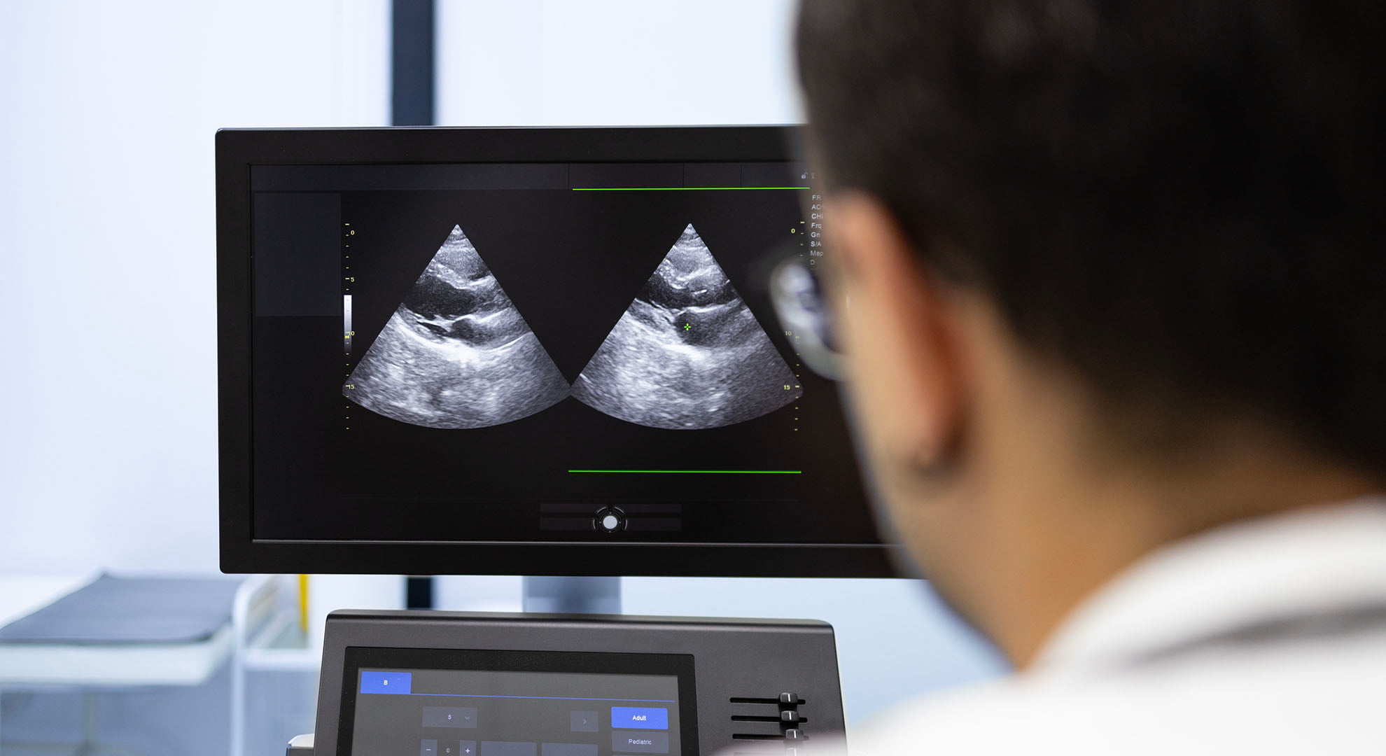 Man looking at the screen of an ultrasound machine.