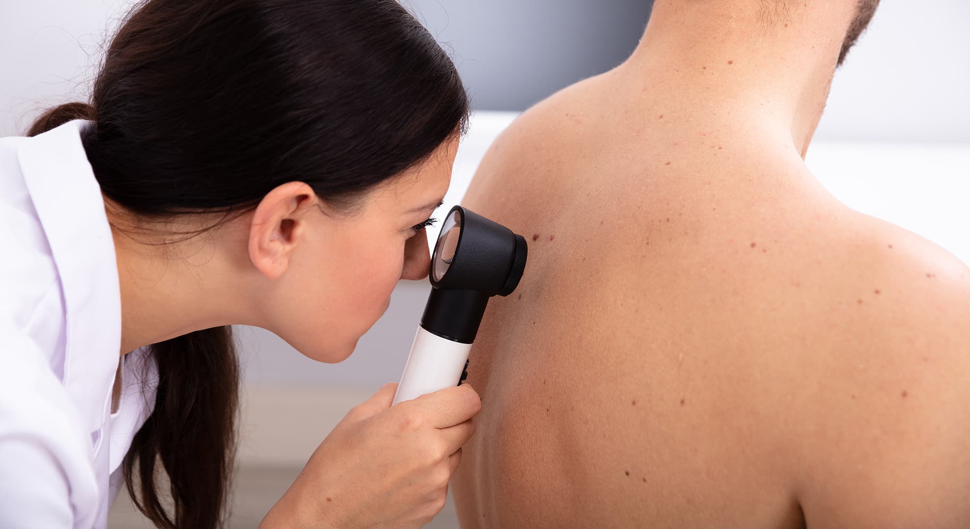 Doctor looking at the skin on a patient's back with a microscope.