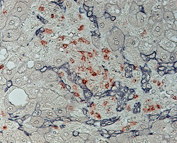 Human liver immunohistochemistry