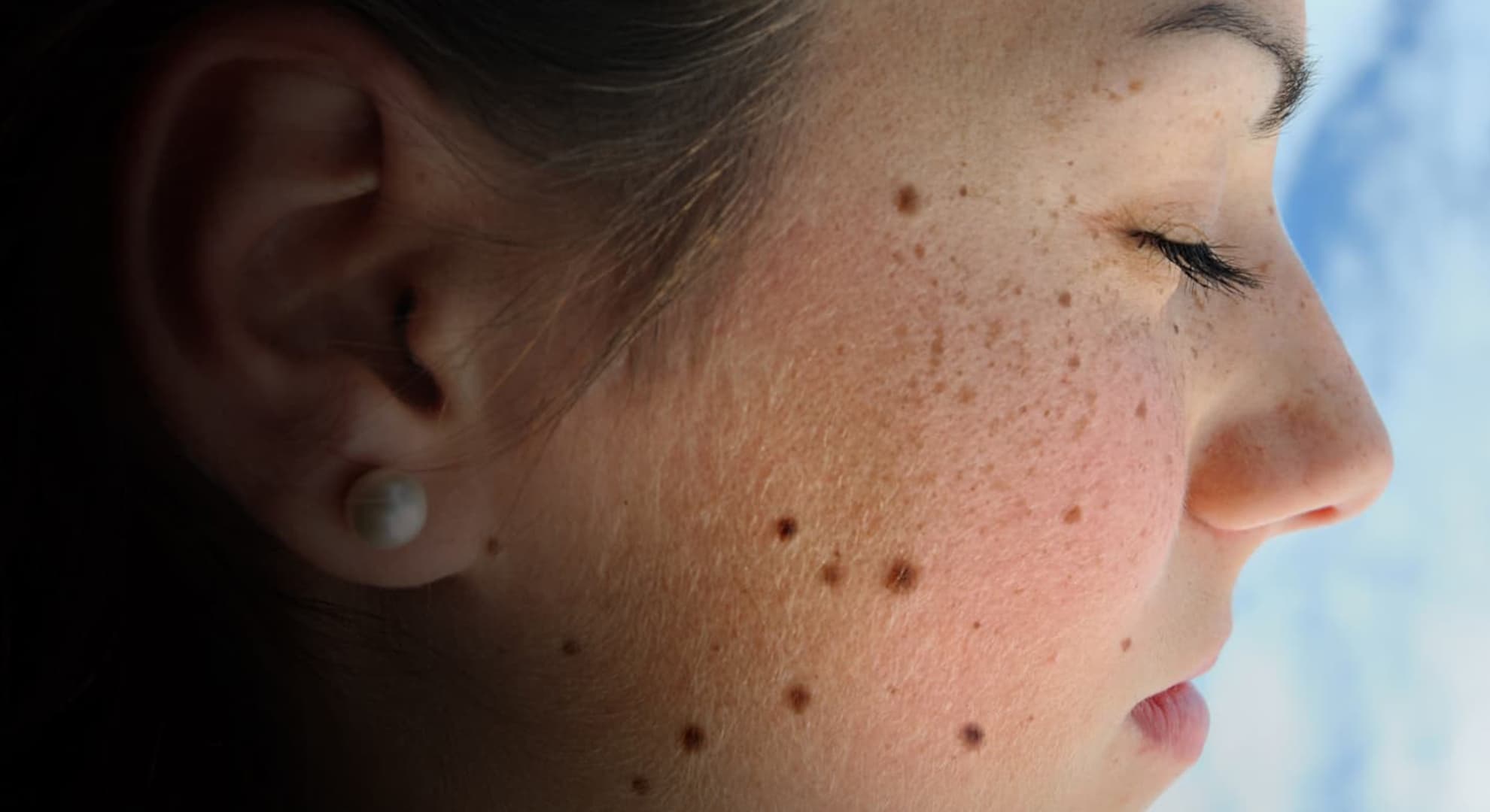 Closeup of young woman's face with freckles