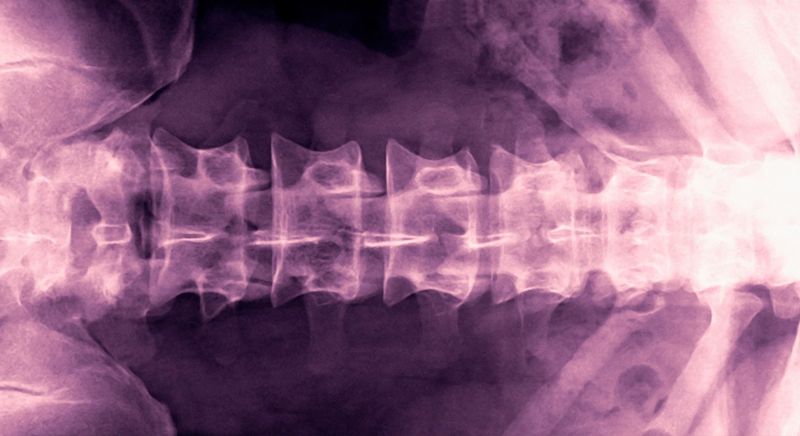 X-ray of normal spine