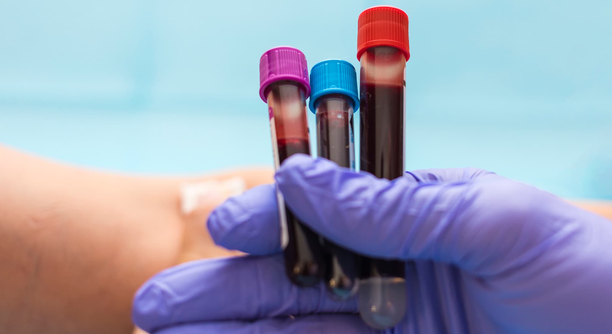 Gloved hand hold vials of blood